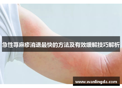 急性荨麻疹消退最快的方法及有效缓解技巧解析